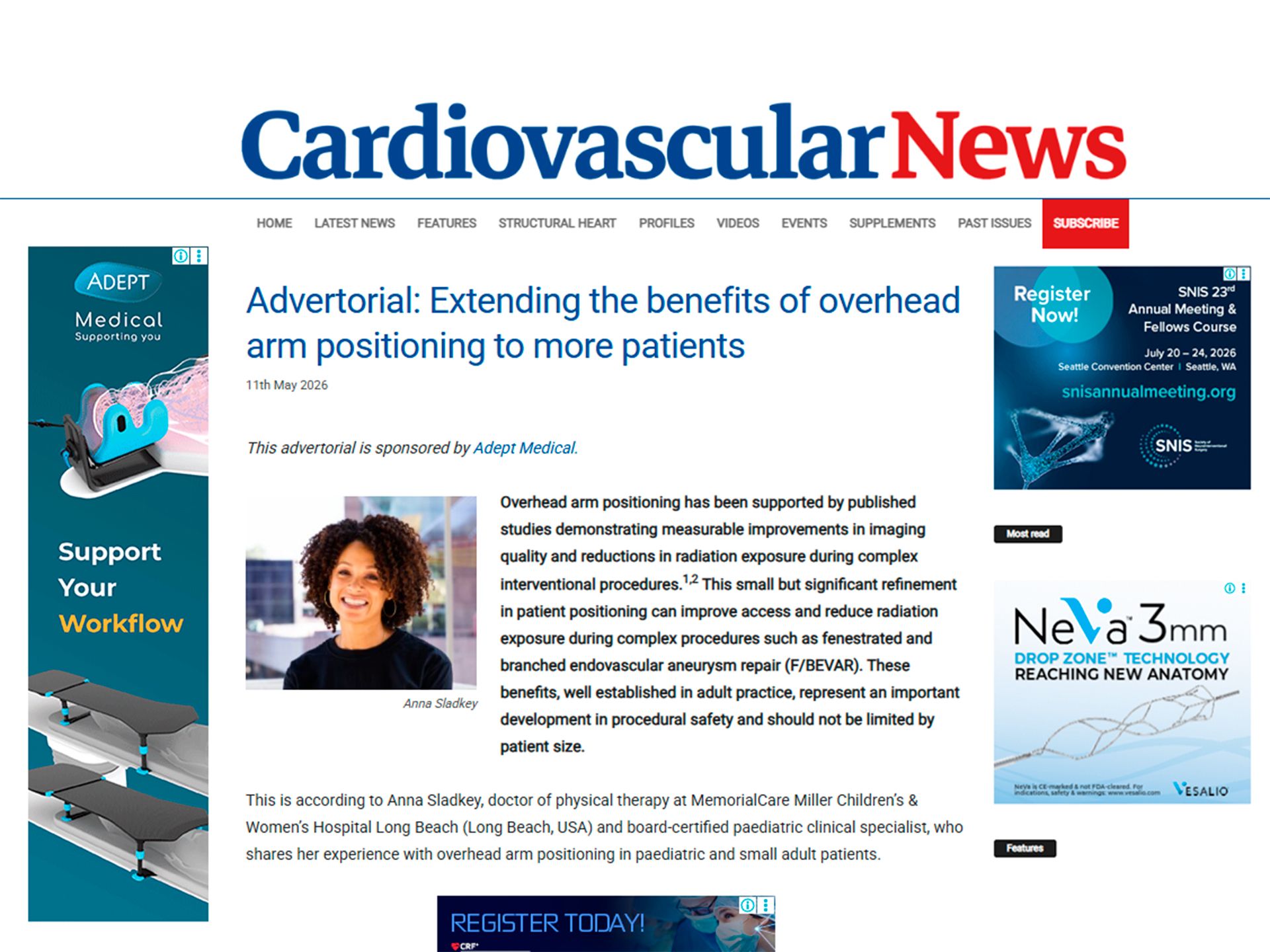 A webpage for "Cardiovascular News" featuring an article about overhead arm positioning, with various advertisements and a sidebar.